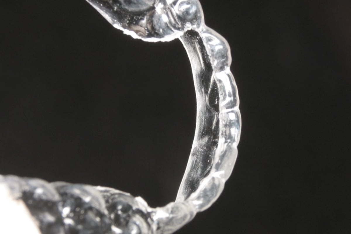 Orthodontic Retention - Clear Retainer